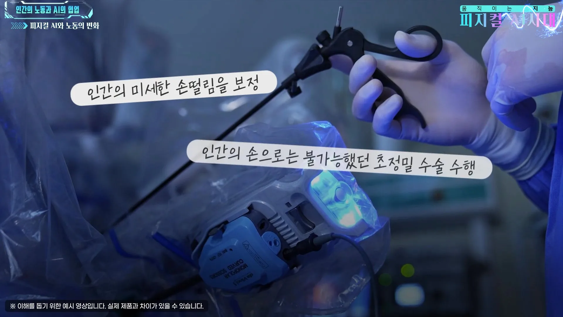 손떨림을 보정하는 초정밀 수술 로봇